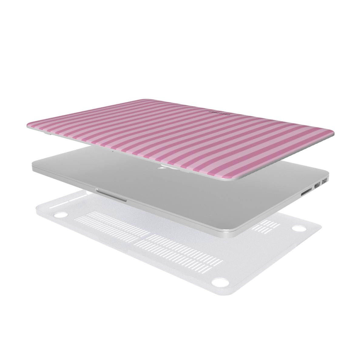 Candystripe - MacBook Case